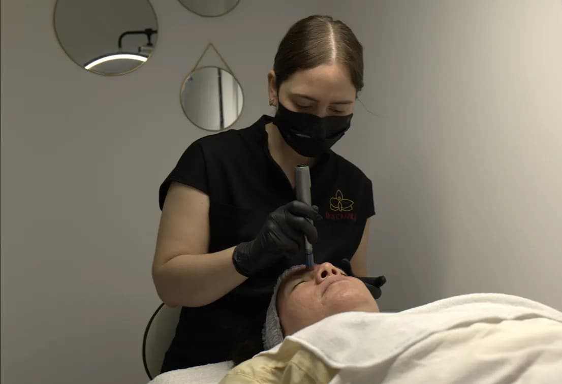 Tratamiento de Dermapen Corporal