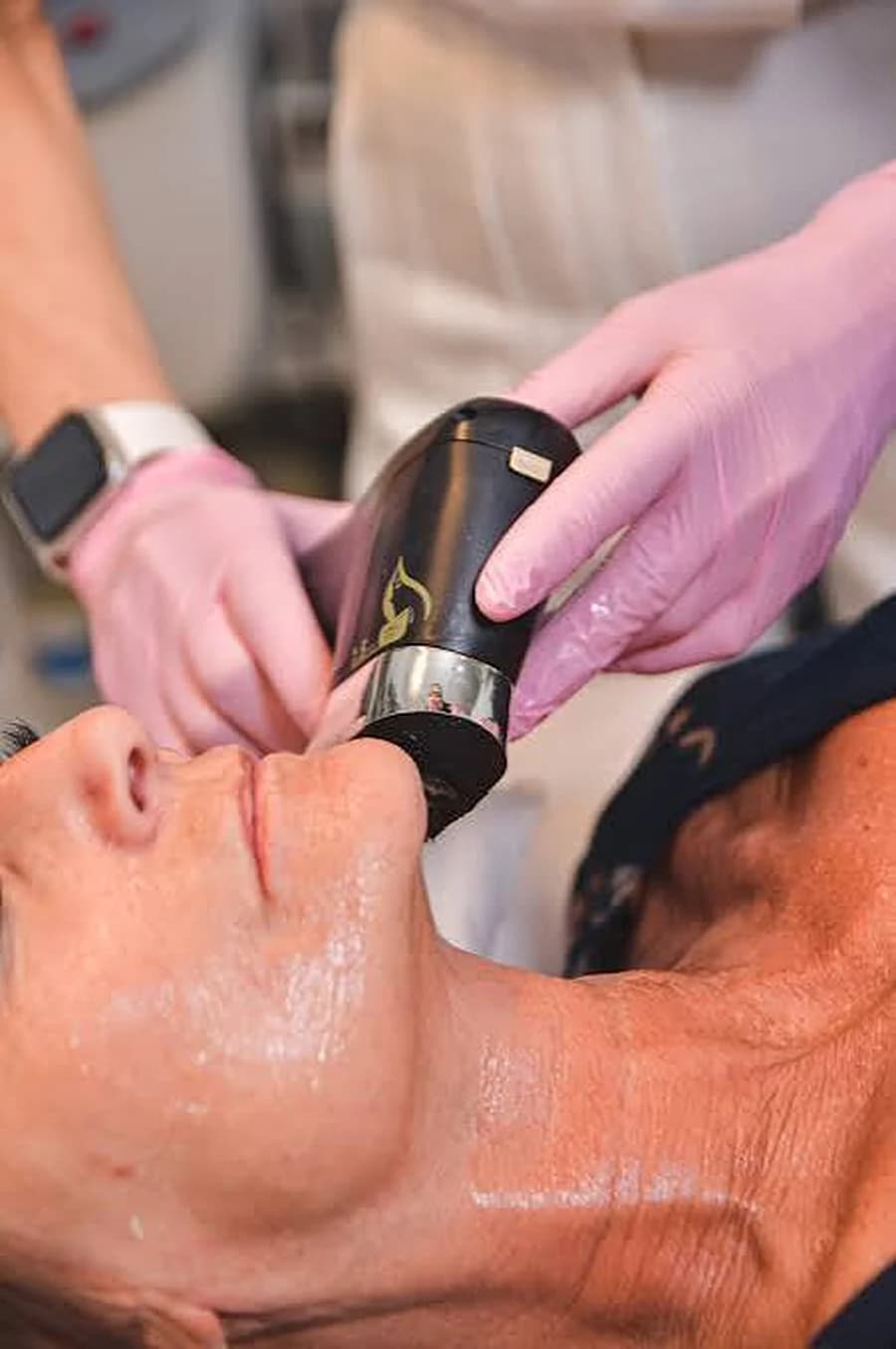 Sesión de HIFU facial realizada por médica en Clínica Cambria
